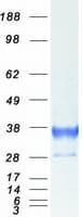 Human CD74 / CLIP Protein (Recombinant Myc-DDK (Flag))
