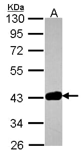 Polyclonal Rabbit anti-Human GRAP2 / GRID Antibody (aa1-174, IHC, WB)