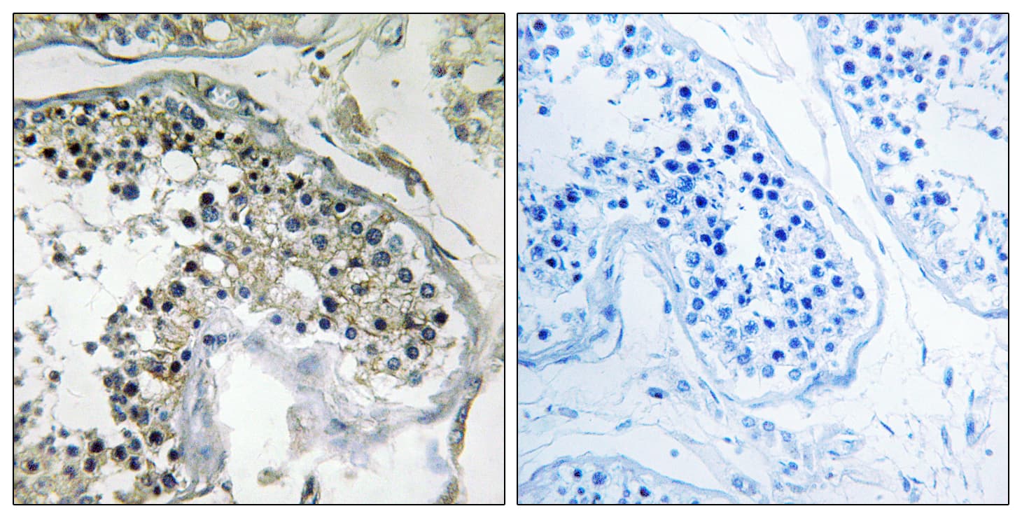 PPP1R1C Antibody (aa5-54)