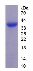 Human MAGP / MFAP2 Protein (Recombinant His, N-Terminal)