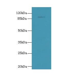TLR6 Antibody