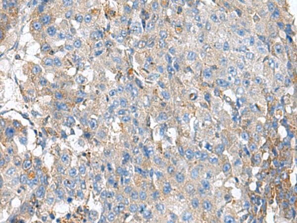 KIAA0556 Antibody