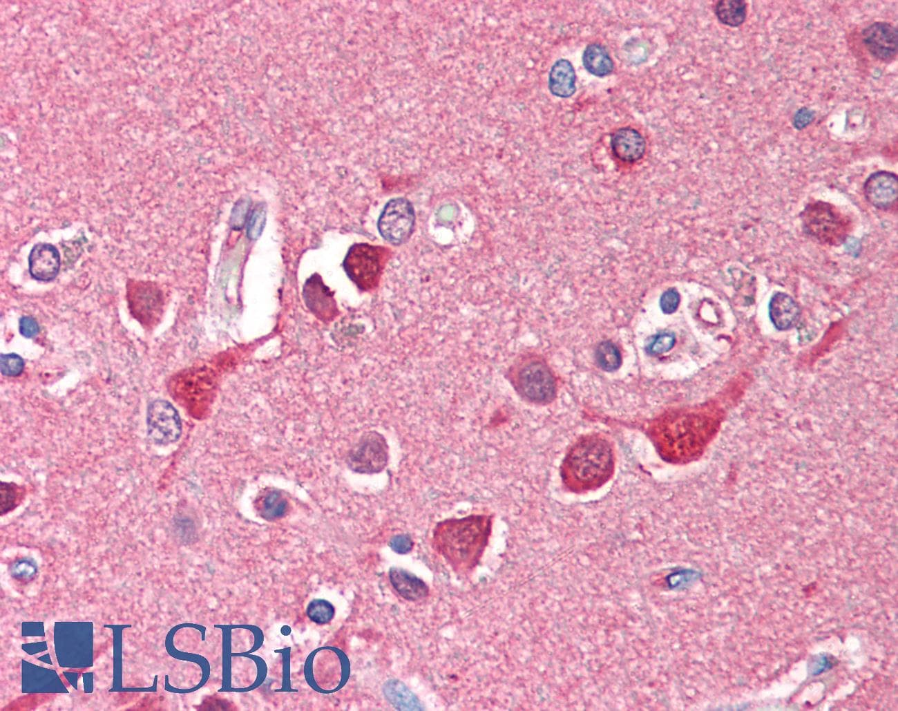 IHC-plus™ TF / Transferrin Antibody