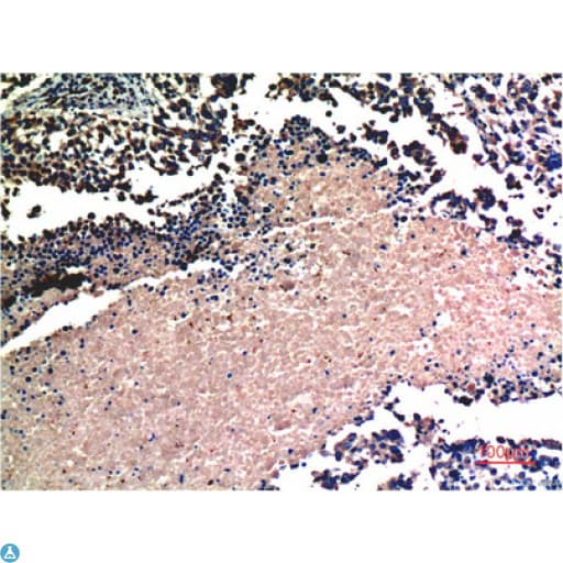 AKT1 Antibody