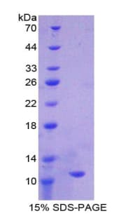 Rat IDO1 / IDO Protein (Recombinant His)