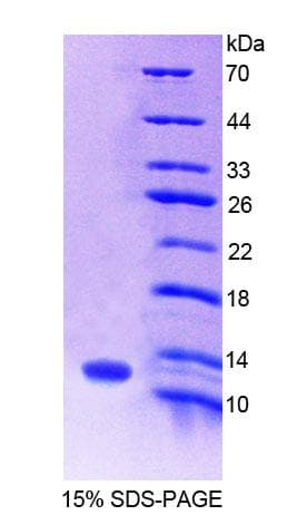 Human S100A8 / MRP8 Protein (Recombinant His)