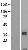 Human T2R42 / TAS2R42 Protein (Over-Expression Lysate Myc-DDK (Flag))