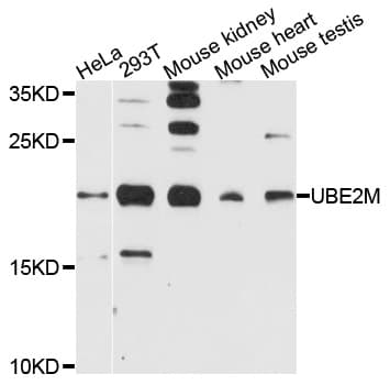 Polyclonal Rabbit anti-Human UBE2M / UBC12 Antibody (WB)