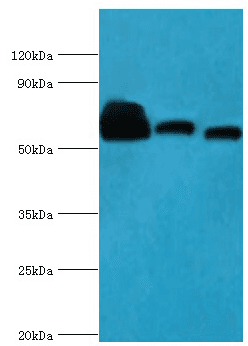 Polyclonal Rabbit anti-Human ABAT Antibody (aa29-300, IHC, WB)
