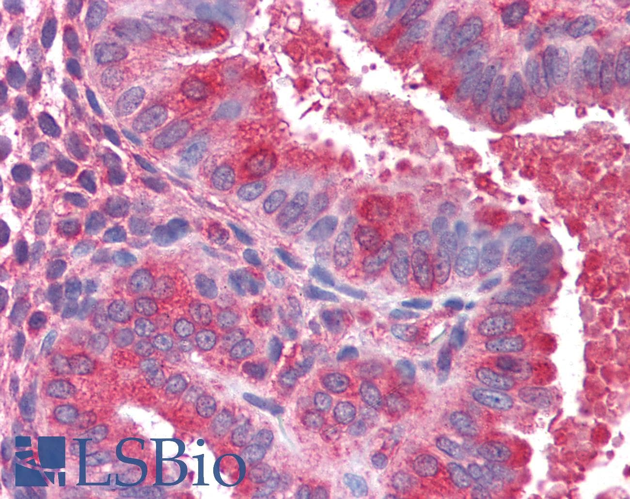 IHC-plus™ ACTR1B Antibody (aa363-375)