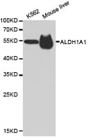 Polyclonal Rabbit anti-Human ALDH1A1 / ALDH1 Antibody (IHC, WB)