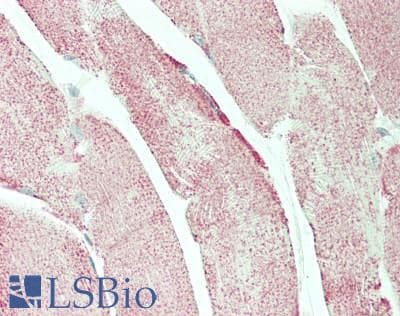 IHC-plus™ ATP5B / ATP Synthase Beta Antibody (clone 5G2)