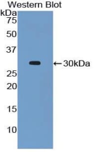 CASP8 / Caspase 8 Antibody (aa1-218)