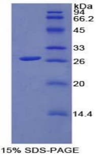 Rat FGFRL1 Protein (Recombinant His-T7)
