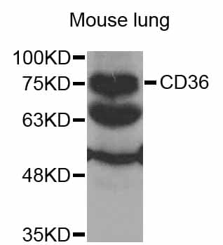 Polyclonal Rabbit anti-Human CD36 Antibody (IF, WB)