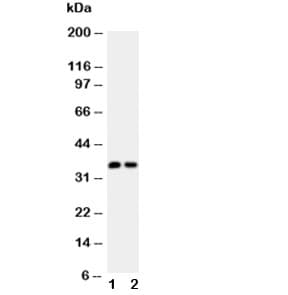 CALB1 / Calbindin Antibody (aa2-175)
