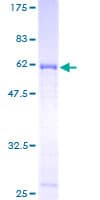 Human SFRP1 Protein (Recombinant GST)