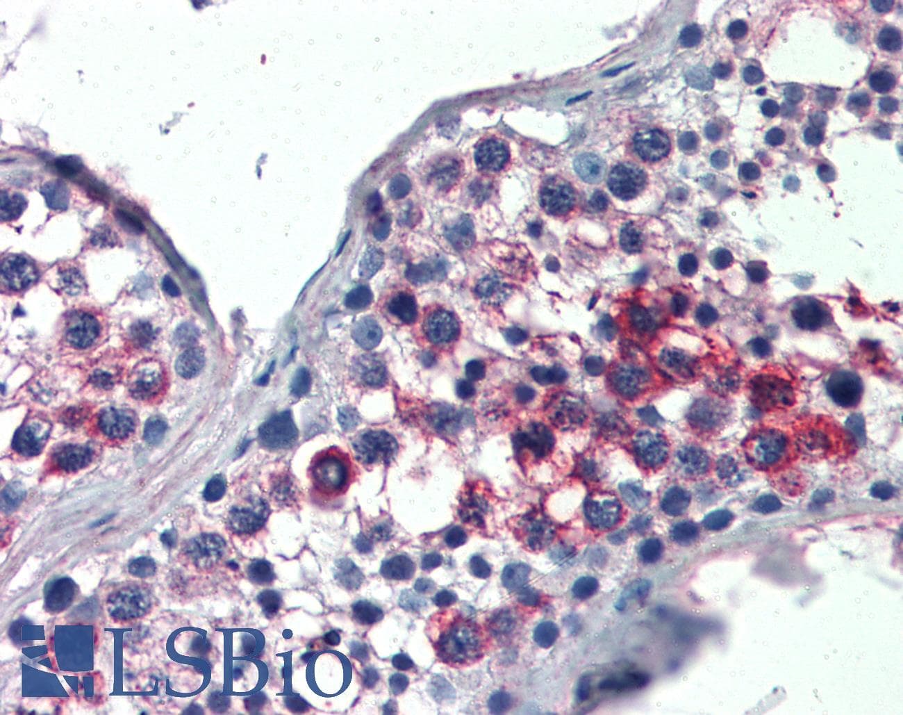 IHC-plus™ SLIM / FHL1 Antibody (aa261-272)