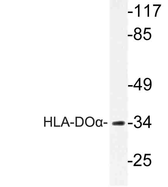 HLA-DOA Antibody (Val111)