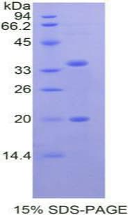 Human SPINK5 / LEKTI Protein (Recombinant His-T7)