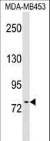 POMT2 Antibody (aa540-567)