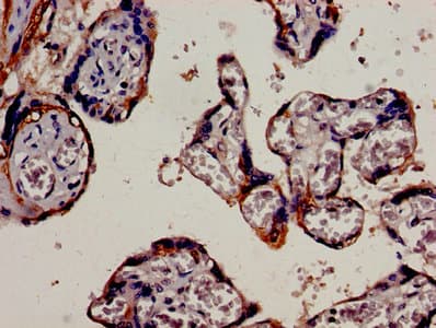 KRT18 / CK18 / Cytokeratin 18 Antibody