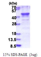 Human BABAM1 / HSPC142 Protein (Recombinant His)