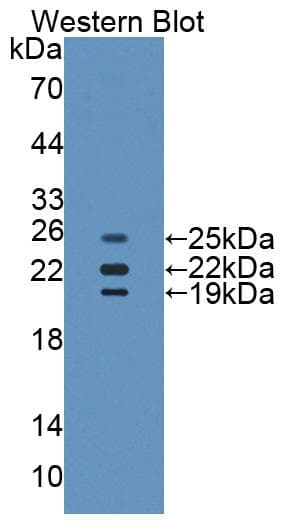 CAT / Catalase Antibody (aa401-523, PE)