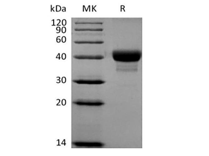 Human CD52 Protein (Recombinant Fc-AVI, C-terminus)