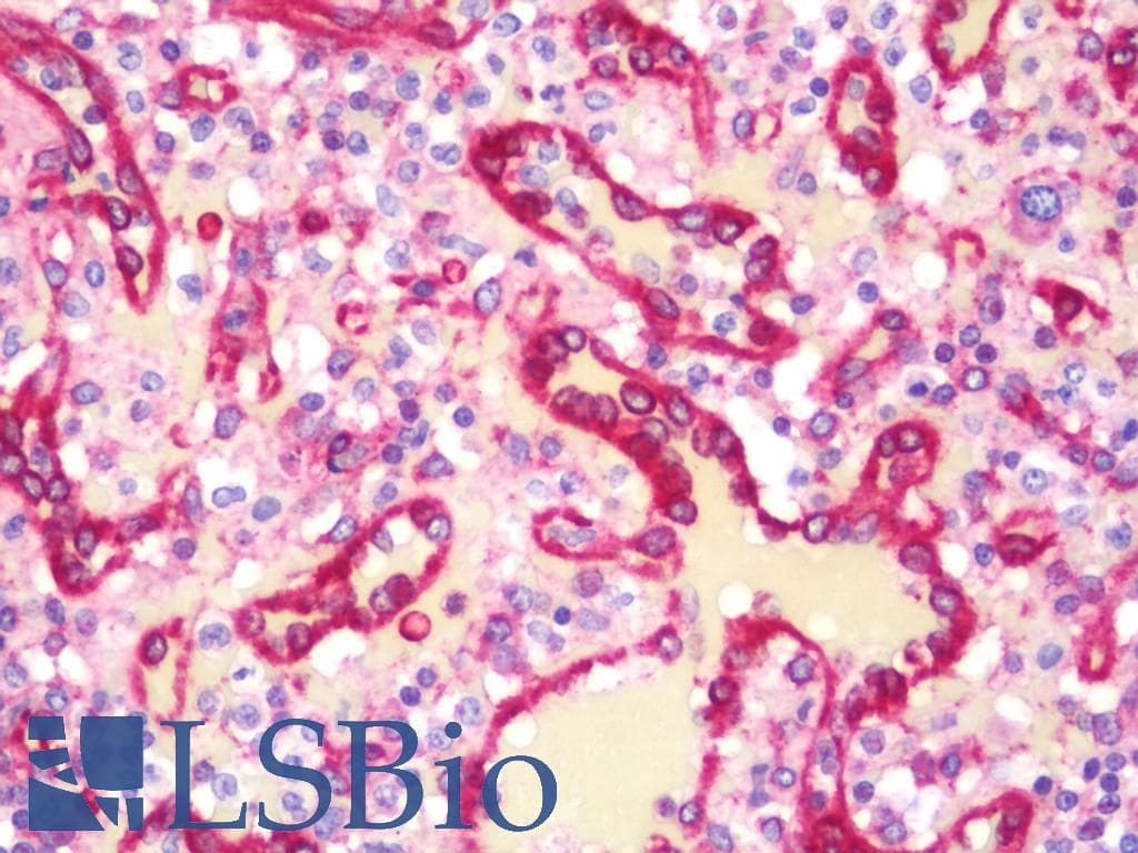 IHC-plus™ MAP4 Antibody (aa1102-1152)