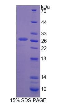 Rat TRIM21 / RO52 Protein (Recombinant His, N-Terminal)