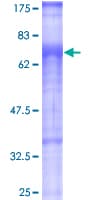Human TGFBRAP1 / TRAP-1 Protein (Recombinant GST)