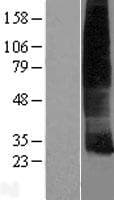 CMTM8 Protein (Over-Expression Lysate Myc-DDK (Flag))