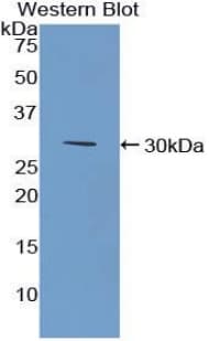 CD157 Antibody (aa63-313, HRP)