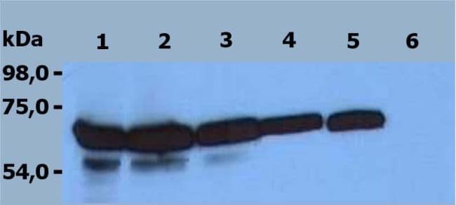 ZAP70 Antibody (clone ZAP-03)