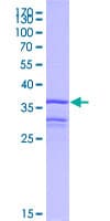 Human CCL4L2 Protein (Recombinant GST, N-terminus)
