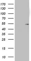 KRT20 / CK20 / Cytokeratin 20 Antibody (clone OTI4B4)