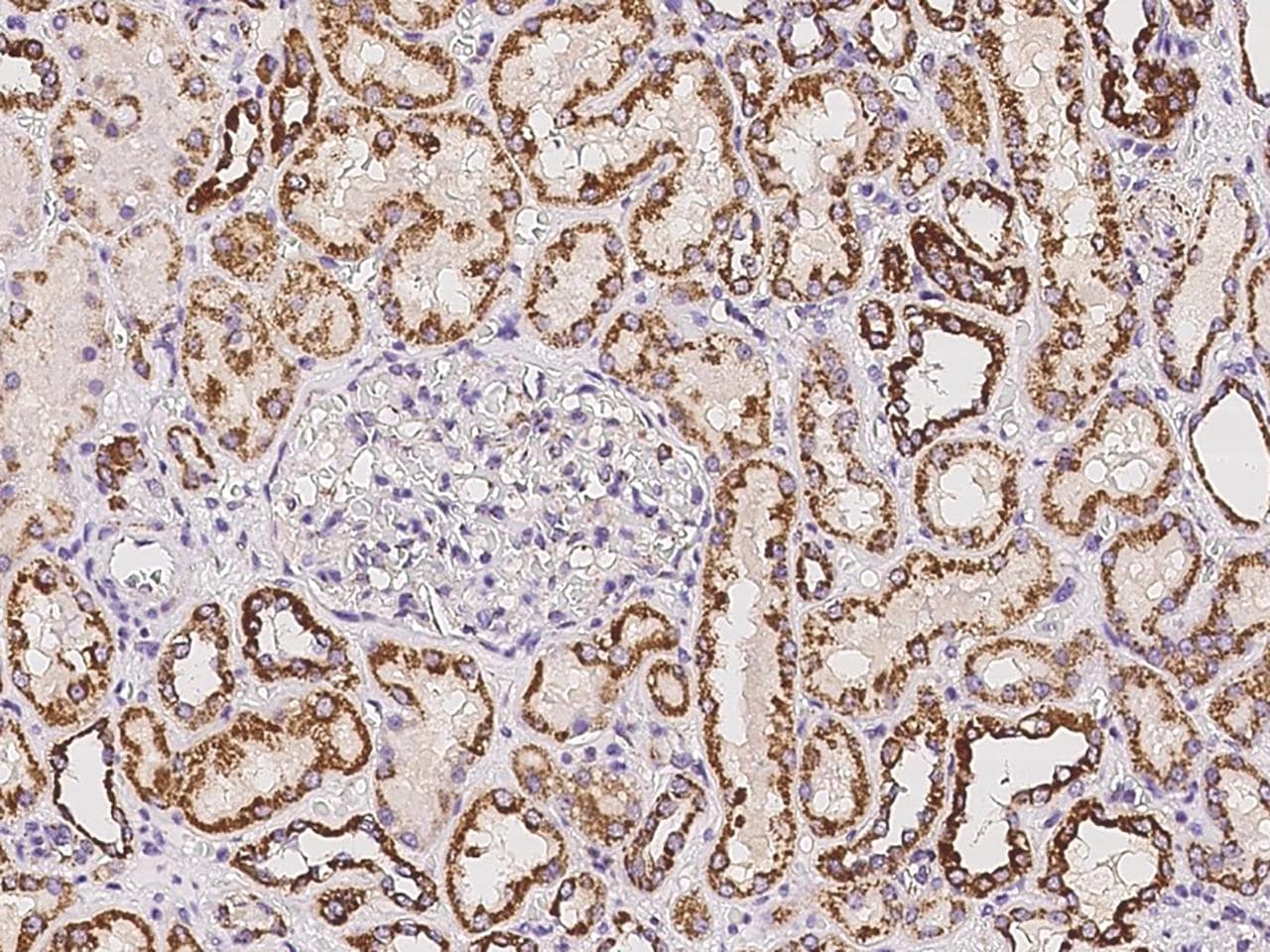 ATP5O Antibody
