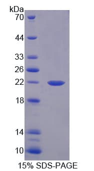 Mouse FLT3LG / Flt3 Ligand Protein (Recombinant His)