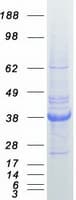Human Osteonectin / SPARC Protein (Recombinant Myc-DDK (Flag))