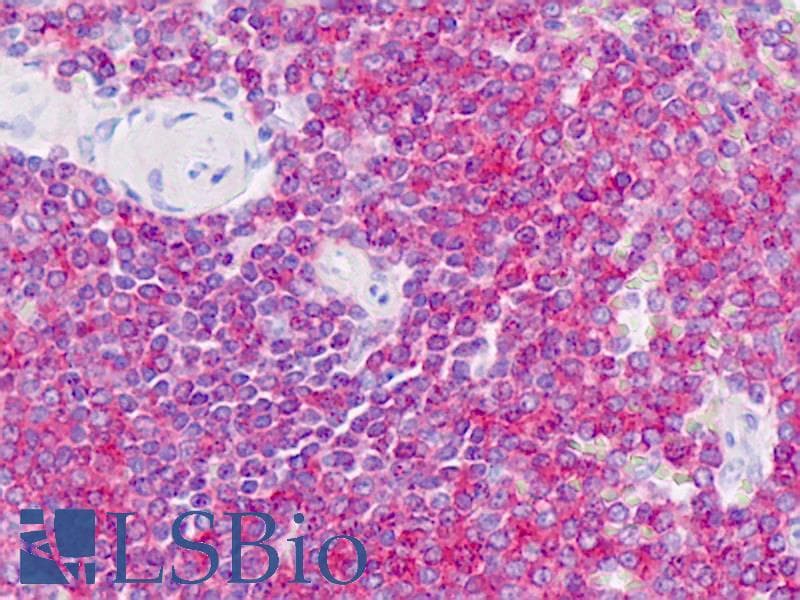 IHC-plus™ RAC2 Antibody (clone AT2G11)