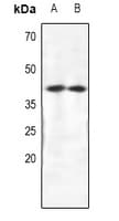 Polyclonal Rabbit anti-Human CRKL Antibody (IHC, IF, WB)