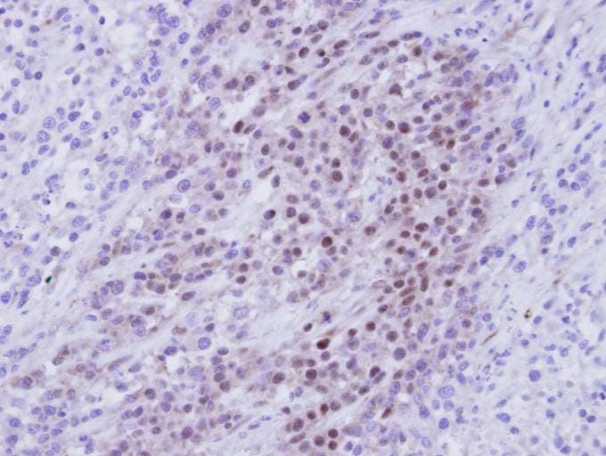 Polyclonal Rabbit anti-Human RBMY1A1 Antibody (aa253-496, IHC, WB)