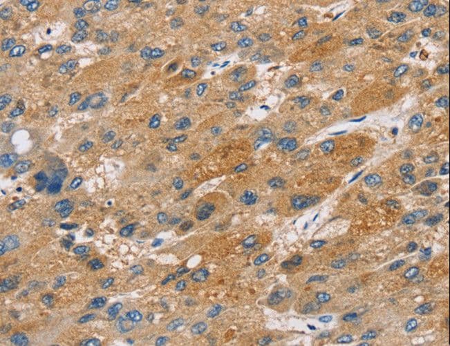 ST18 Antibody