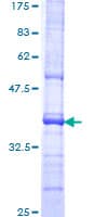 Human PRLTS / PDGFRL Protein (Recombinant GST, N-terminus)