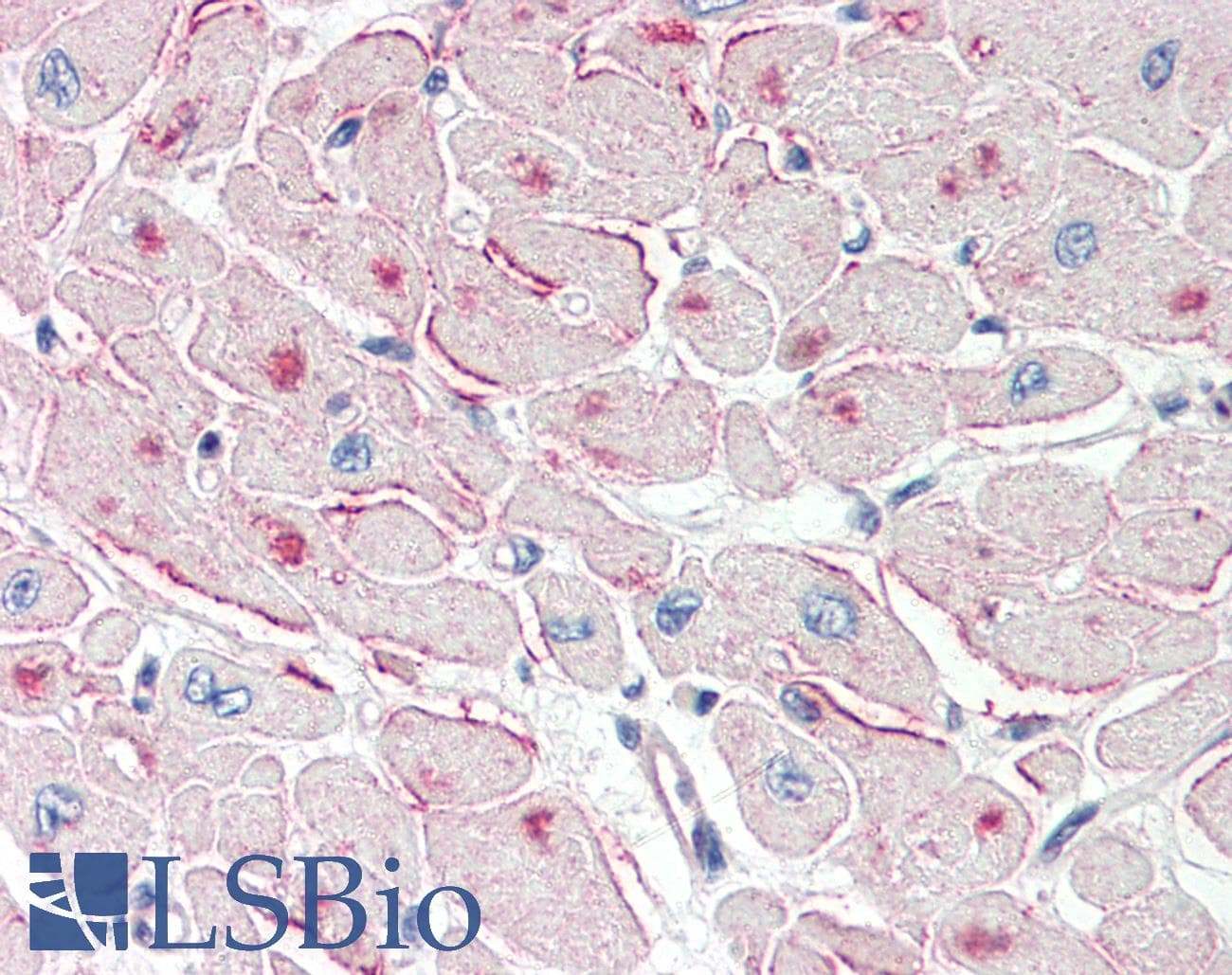 IHC-plus™ PNPLA2 / ATGL Antibody (aa68-79)