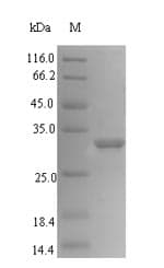 Actinidia deliciosa ypr-10 Protein (Recombinant 6His-SUMO, N-terminus)