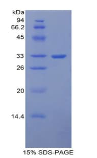 Mouse ITIH1 Protein (Recombinant His-T7)
