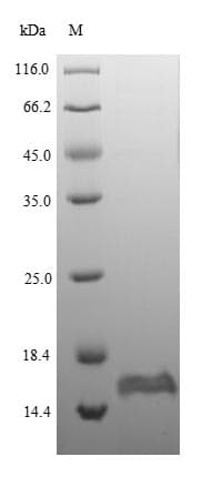 Escherichia coli glpE Protein (Recombinant 6His, N-terminus)