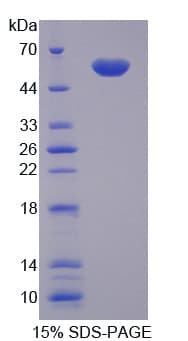 Human NAMPT / Visfatin Protein (Recombinant His-T7, N-terminus)